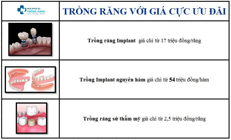 Bang gia trong rang tra gop