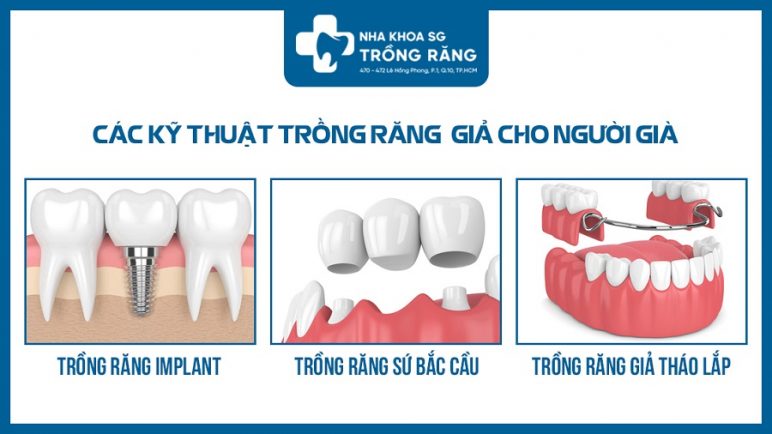 Các kỹ thuật trồng răng giả cho người già