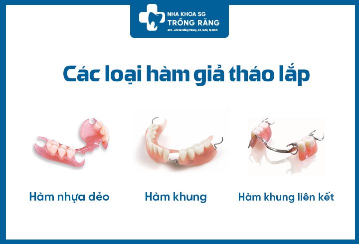 Các loại hàm giả tháo lắp