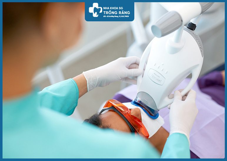 Cách tẩy trắng răng tại nha khoa