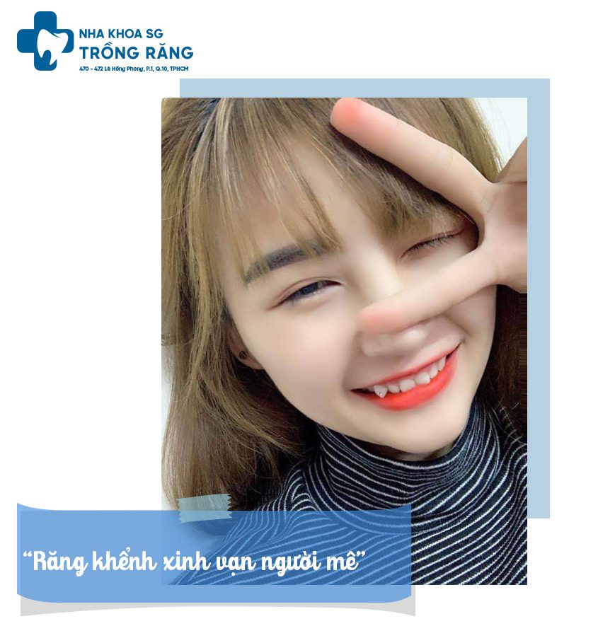 Con gái trồng răng khểnh xinh đẹp