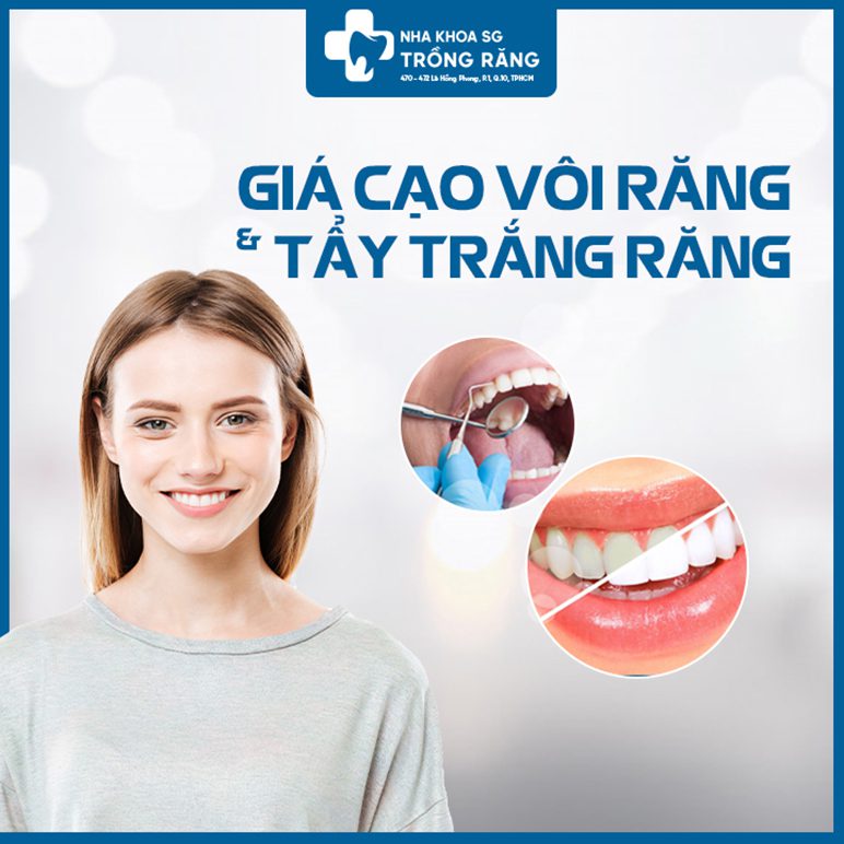 GIÁ CẠO VÔI RĂNG VÀ TẨY TRẮNG RĂNG