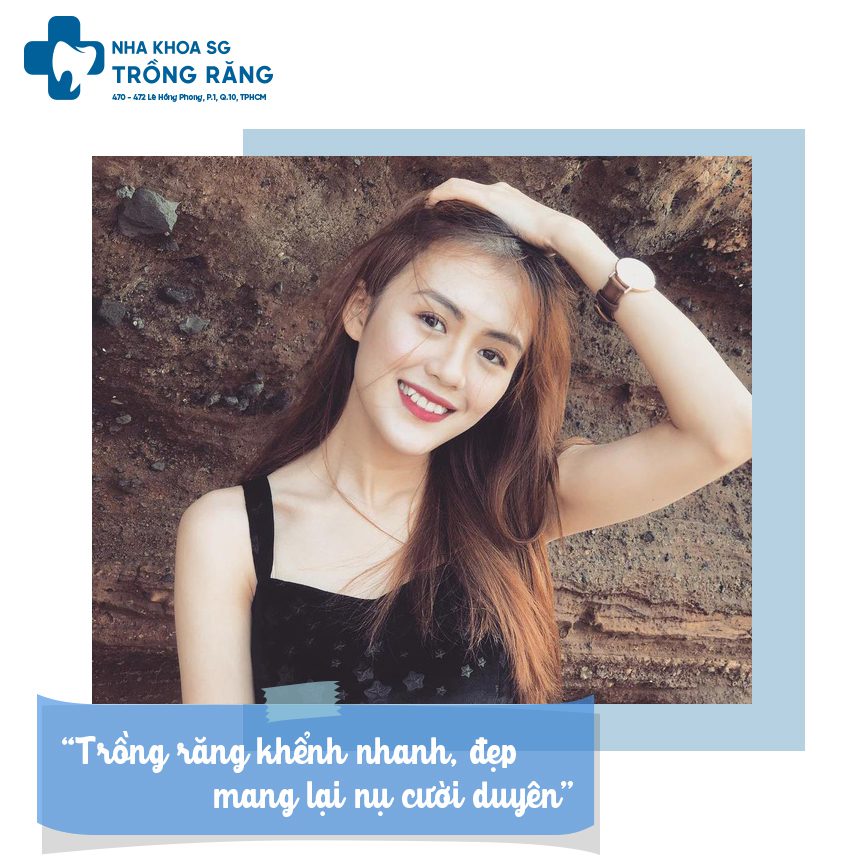 Hotgirl trồng răng khểnh