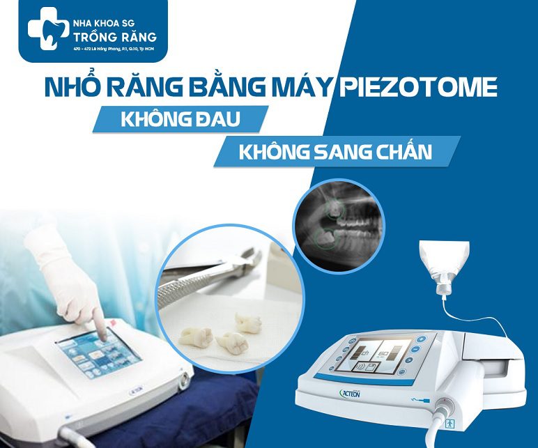 Nho rang bang may sieu am Piezotome 1 1 Nho rang bang may sieu am Piezotome 1 1