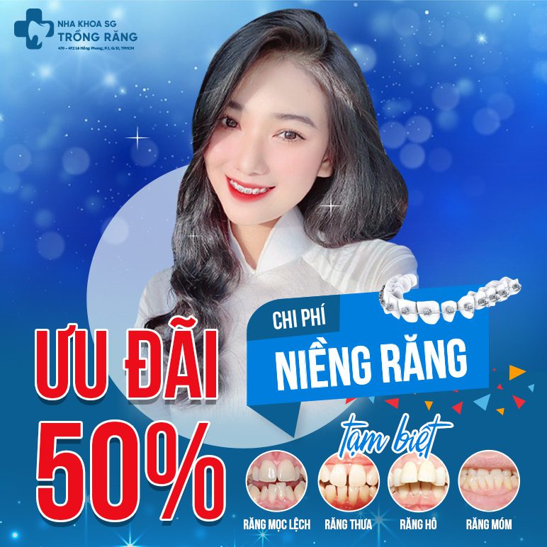 Niềng răng ưu đãi 50% chi phí tại nha khoa trồng răng sài gòn
