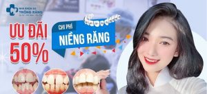 Niềng răng ưu đãi 50% chi phí - banner nha khoa