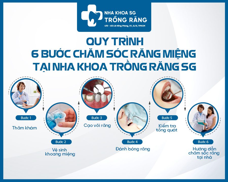 Quy trình 6 bước cạo vôi răng