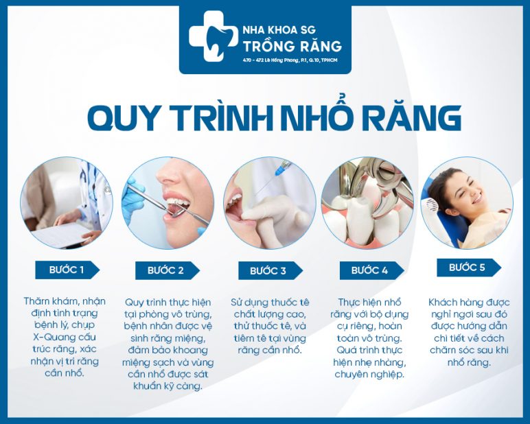 Quy trình nhổ răng không đau Quy trình nhổ răng không đau