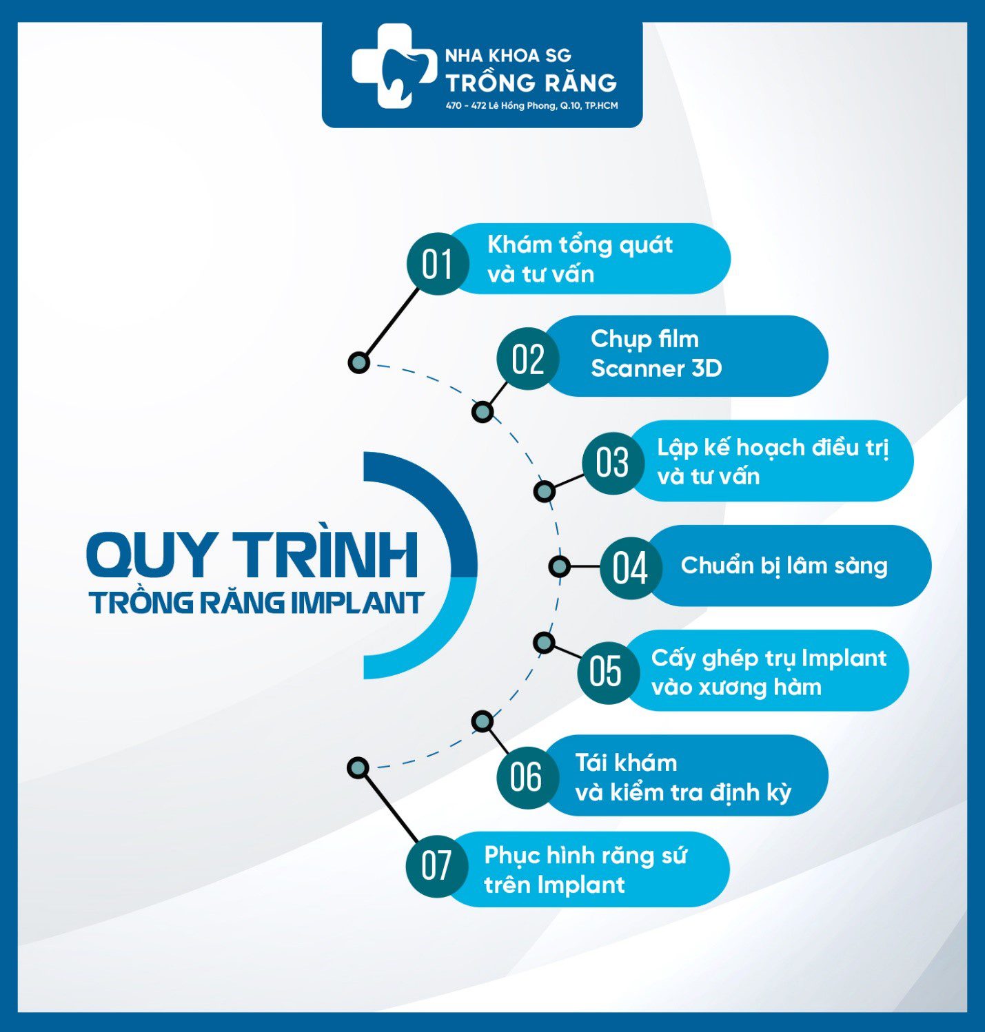 Quy trình trồng răng implant