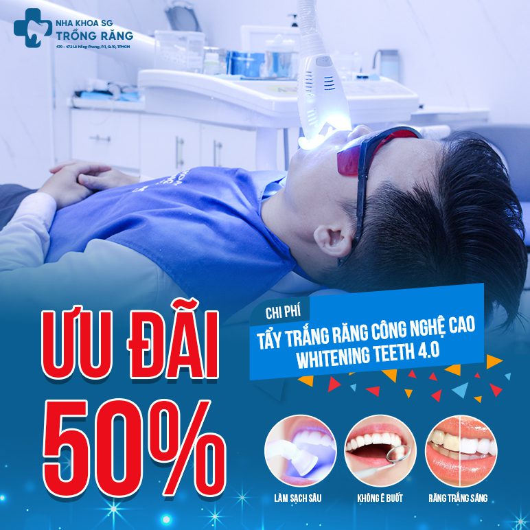 Tay trang rang uu dai 50 chi phi Tẩy trắng răng ưu đãi 50% chi phí