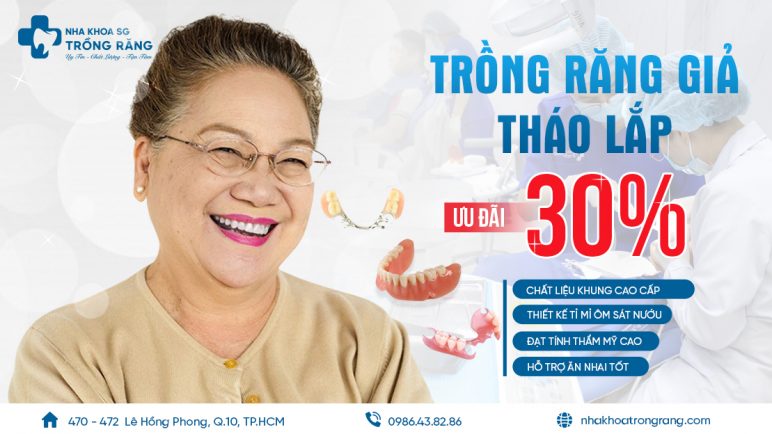 Trồng răng giả tháo lắp khuyến mãi 30% chi phí - thumnail