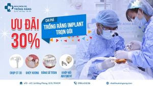 Ưu đãi 50% chi phí trồng răng implant banner web