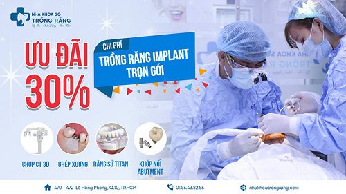 Ưu đãi 50% chi phí trồng răng implant banner web