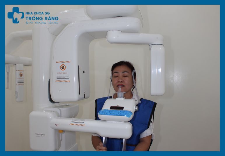 chup x quang xuong rang