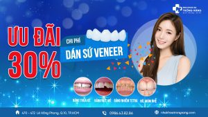 dan su veneer khuyen mai