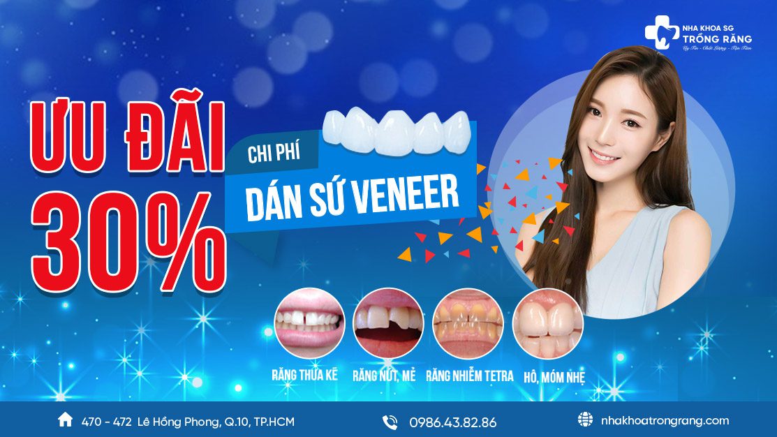 dan su veneer khuyen mai