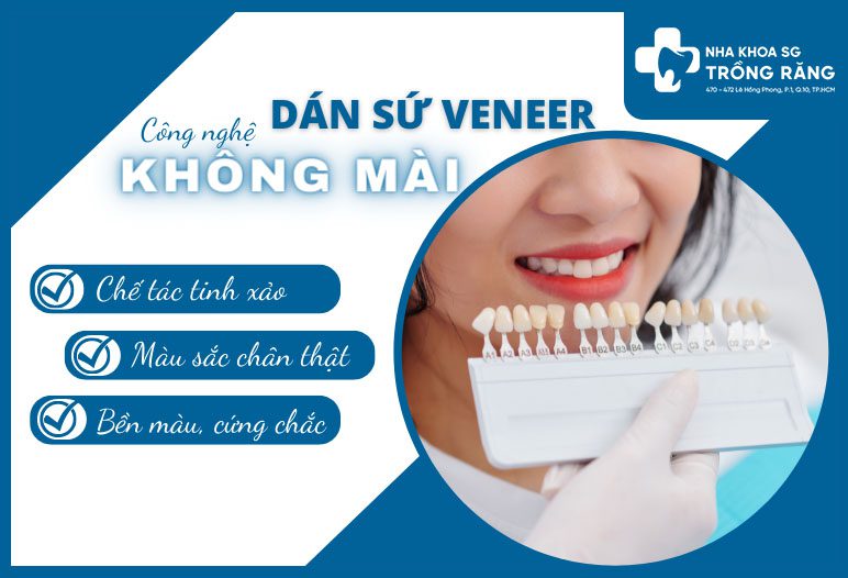 dan su veneer dan su veneer