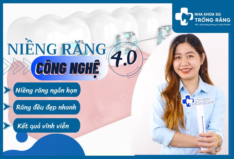 nieng rang cong nghe moi