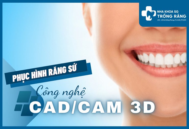 rang su cadcam3d
