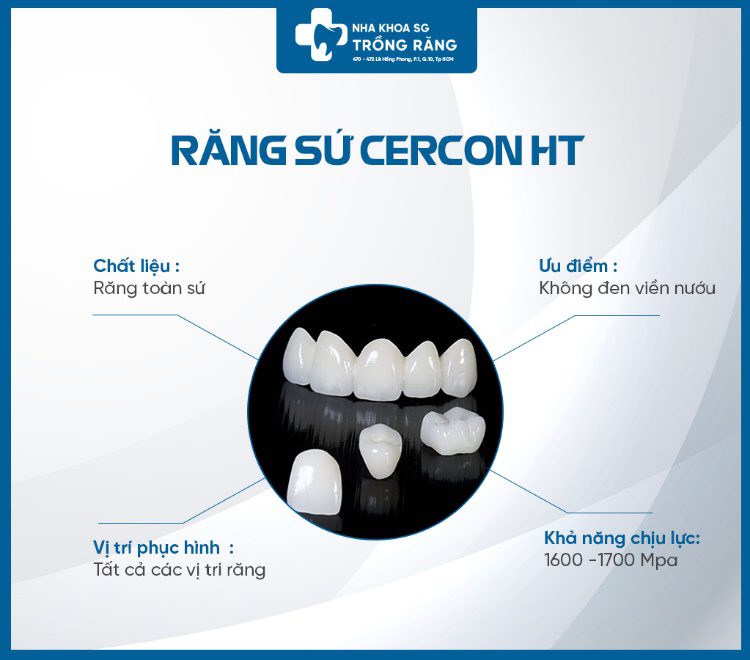 trồng răng bắc cầu bằng răng sứ cercon ht