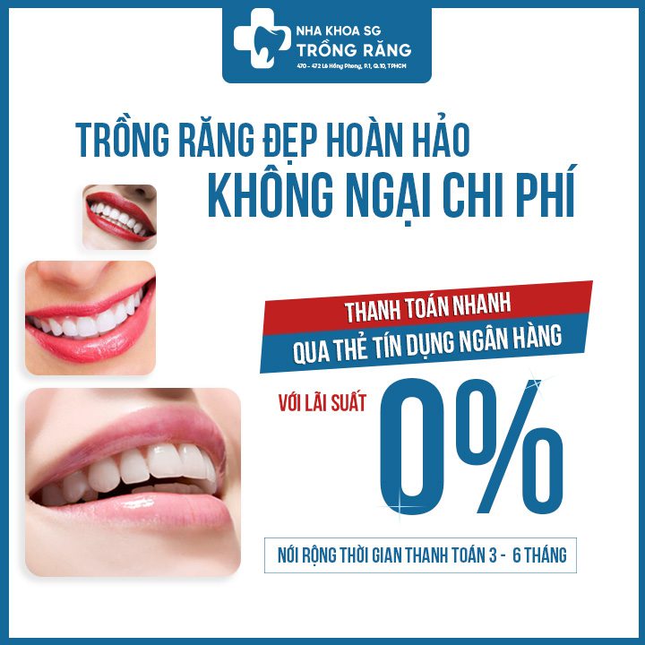 trồng răng trả góp 0% tại nha khoa trồng răng sài gòn