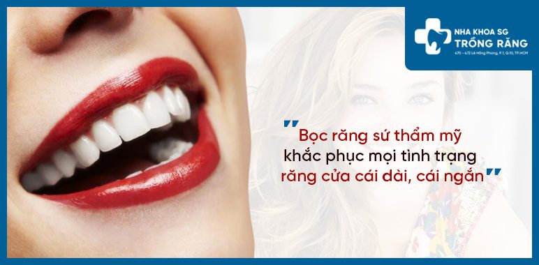 Bọc răng sứ thẩm mỹ răng cửa dài cái ngắn