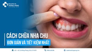 Cách chữa viêm nha chu đơn giản và tiết kiệm nhất