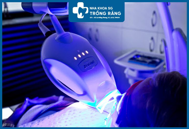 Chiếu đèn tẩy trắng răng