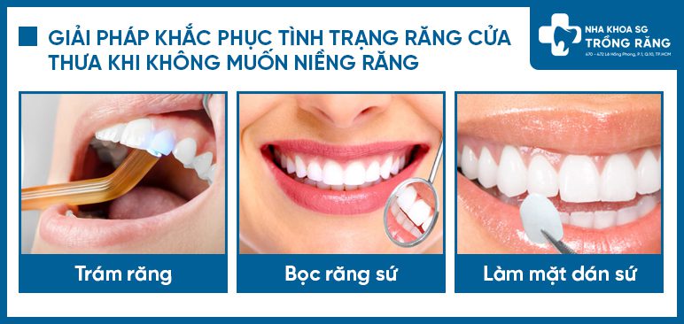 Giải pháp khép răng cửa thưa thay niềng