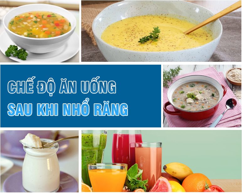 Nên ăn gì sau khi nhổ răng