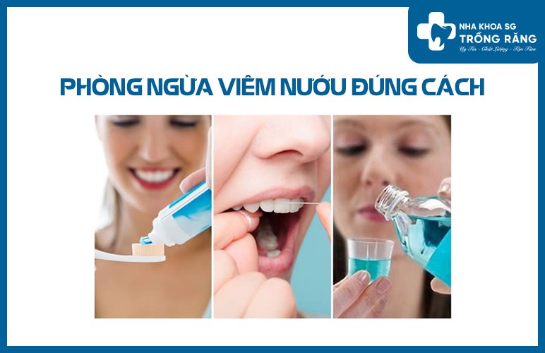 Phòng ngừa viêm nướu đúng cách