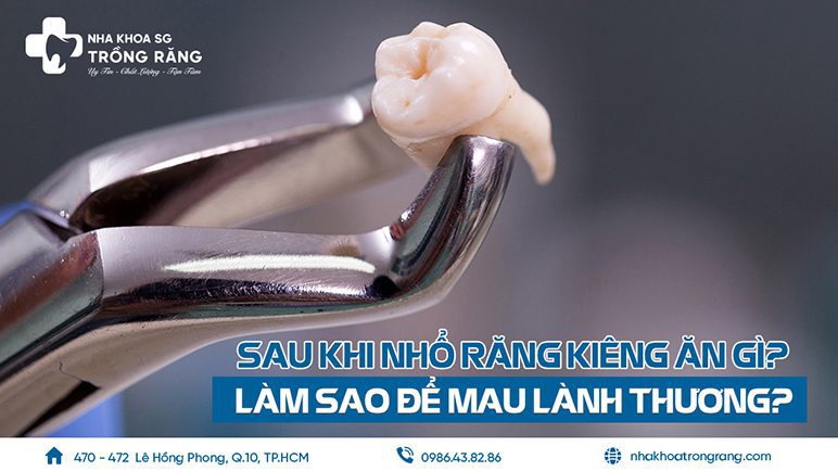 Sau khi nhổ răng nên kiêng gì