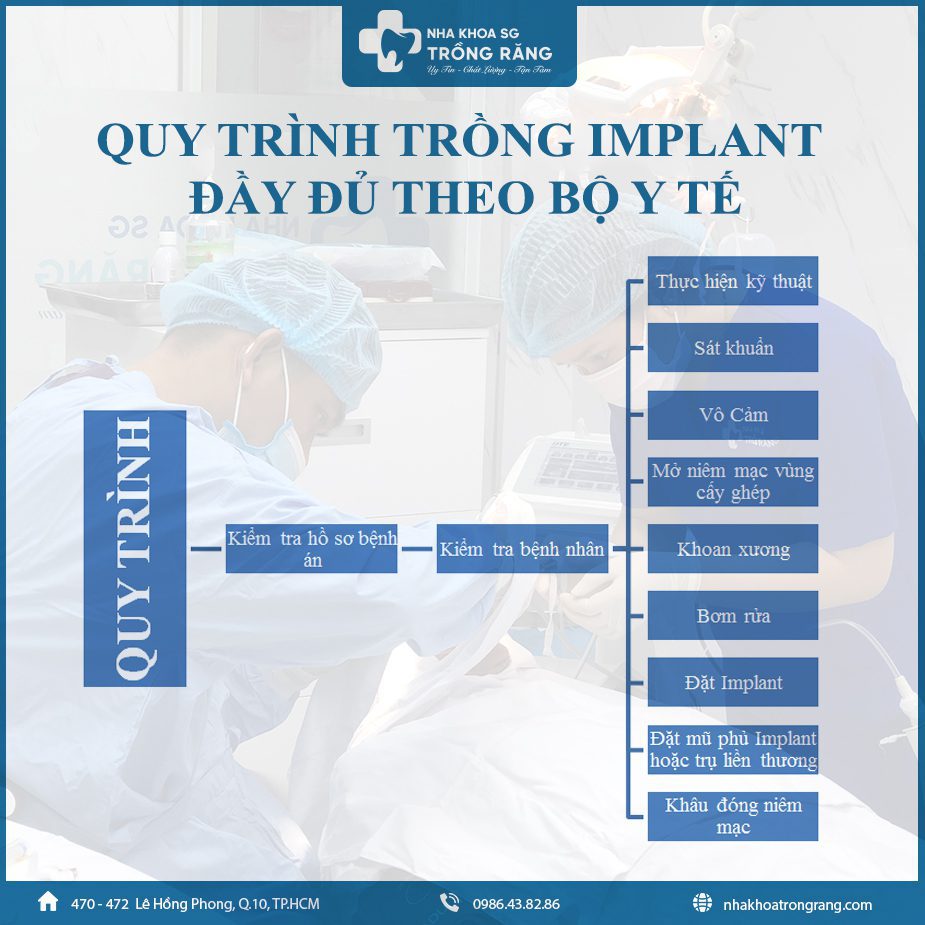 quy trình trồng răng implant