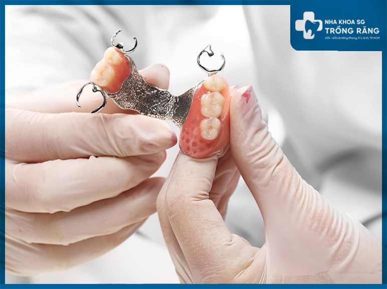 Trồng răng giá rẻ tháo lắp