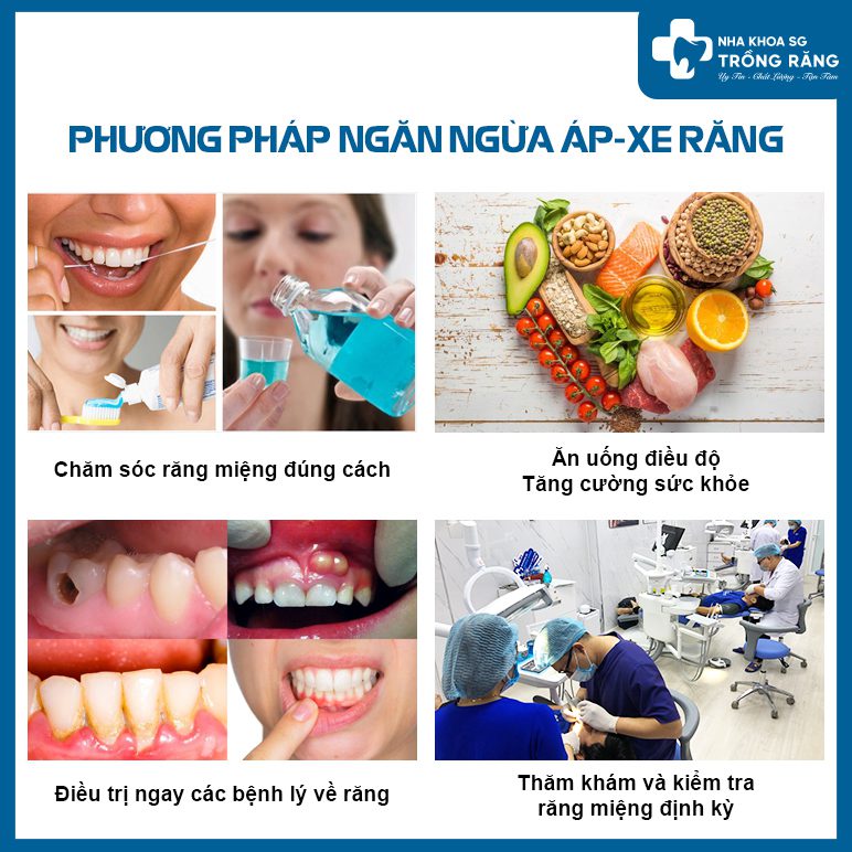 Các phương pháp ngăn ngừa áp xe răng