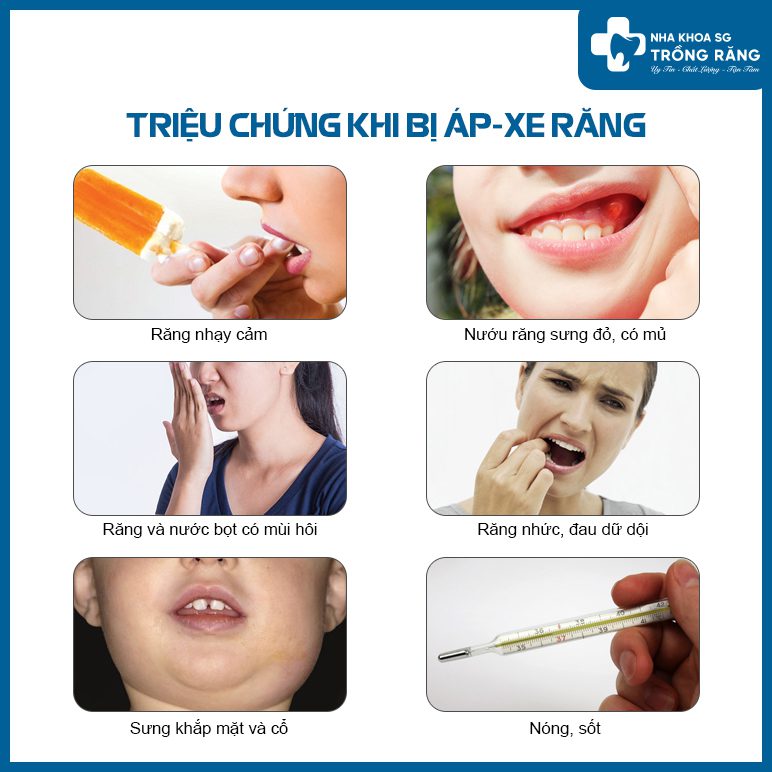 Các triệu chứng khi bị áp xe răng