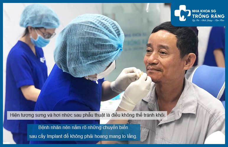 Cách trị sưng mặt sau khi trồng răng Implant