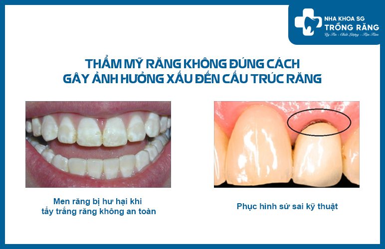 Nguyên nhân gây ê buốt răng