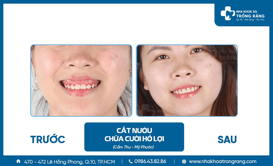 cat nuou chua cuoi ho loi 02 cat nuou chua cuoi ho loi 02