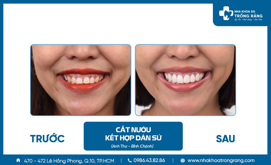 chua cuoi ho loi chua cuoi ho loi