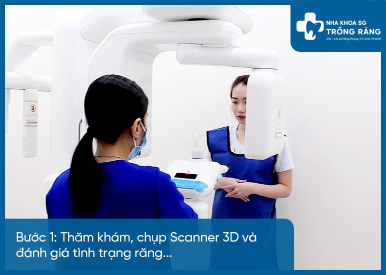 Buoc 1 quy trinh dan rang su Bước 1 quy trình dán răng sứ