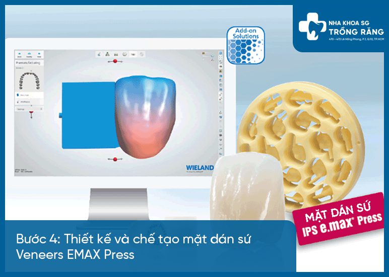 Buoc 4 quy trinh dan rang su Bước 4 quy trình dán răng sứ