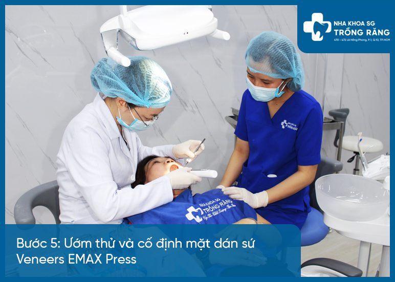 Buoc 5 quy trinh mat dan rang su bac si se gan co dinh Bước 5 quy trình mặt dán răng sứ bác sĩ sẽ gắn cố định