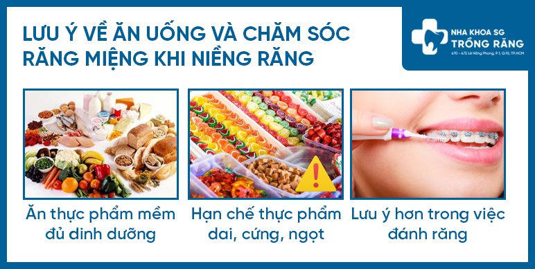 Chăm sóc răng miệng khi niềng răng
