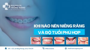 KHI NÀO NÊN NIỀNG RĂNG