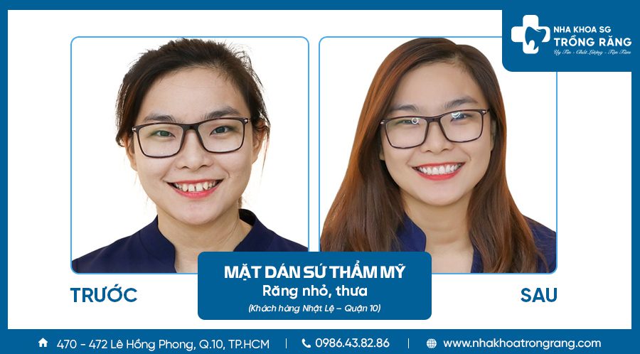 Khach hang lam mat dan su Khách hàng làm mặt dán sứ