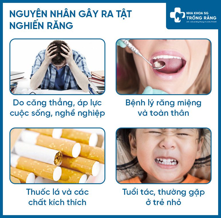 Nguyên nhân bị nghiến răng