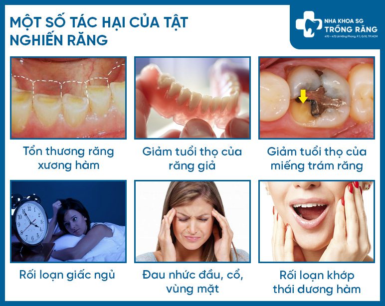 Tác hại khi bị nghiến răng
