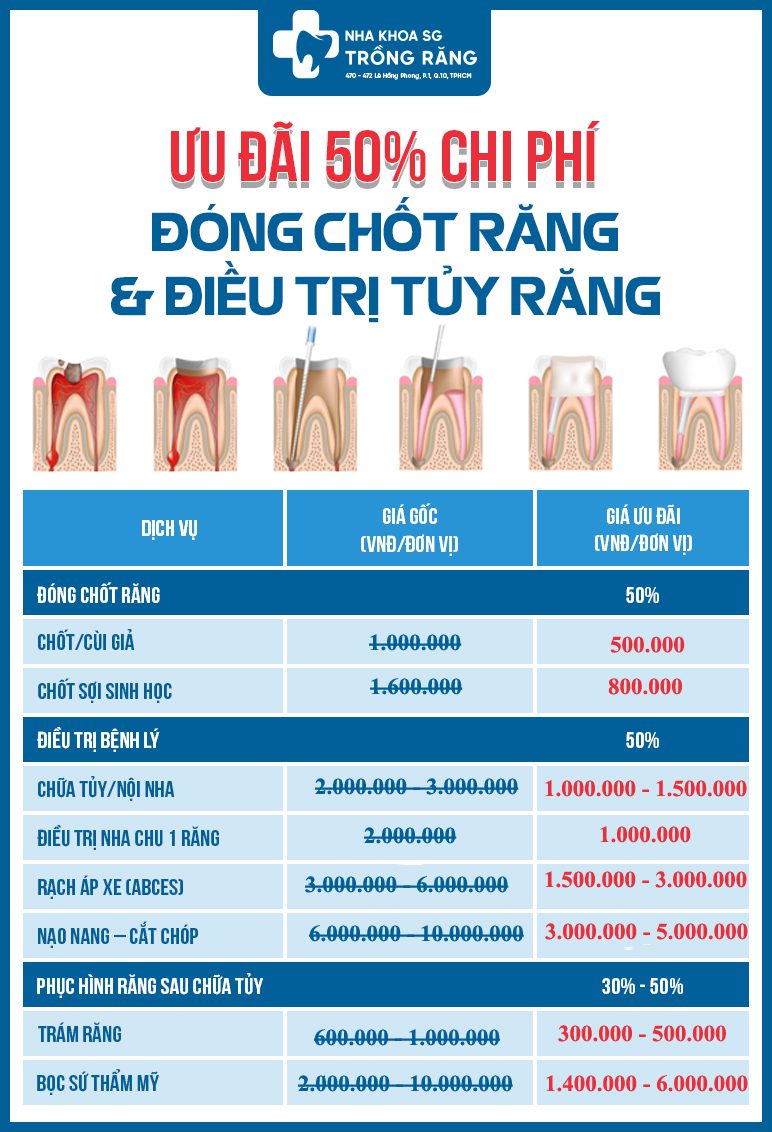 Bang gia dong chot rang chua tuy boc su moi