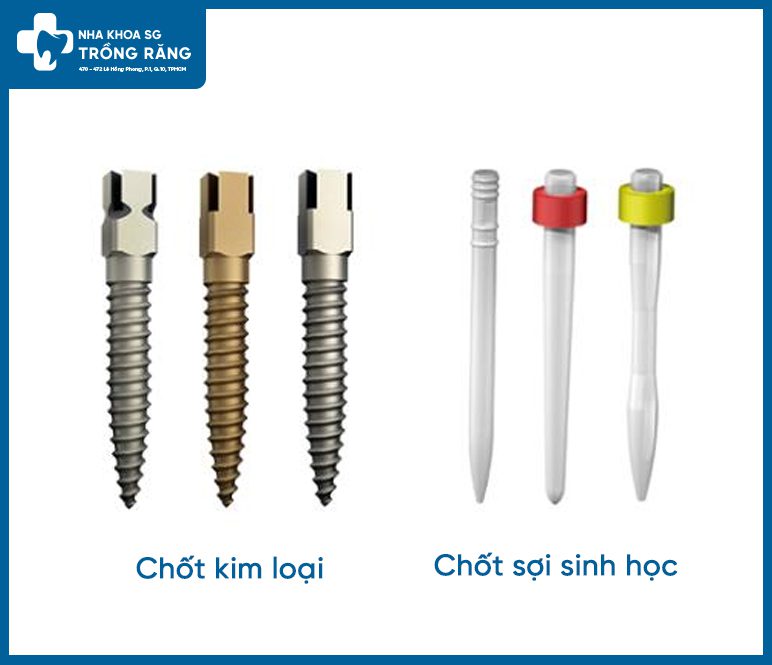 Các loại đóng chốt răng sau khi chữa tủy